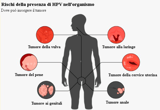 Rischi della presenza di HPV nell'organismo